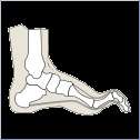 to suggest treatments for abnormal foot conditions any such cases 