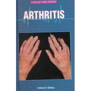  Arthritis Edward Willett Books