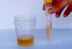 3ppm urine test color remains green no heavy metal ions