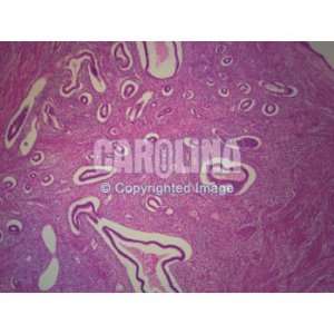 Human Uterus, sec. Microscope Slide, 7 u  Industrial 