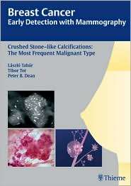   Malignant Type, (3131485310), Laszlo Tabar, Textbooks   