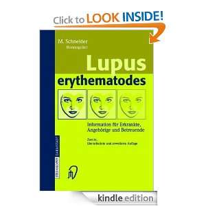 Start reading Lupus erythematodes 