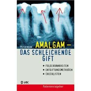 Amalgam   das schleichende Gift. Folgekrankheiten, Entgiftungsmethoden 