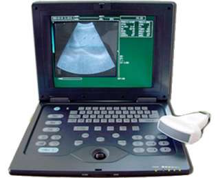 Digital Smart Book Ultrasound Scanner CMS 600P  